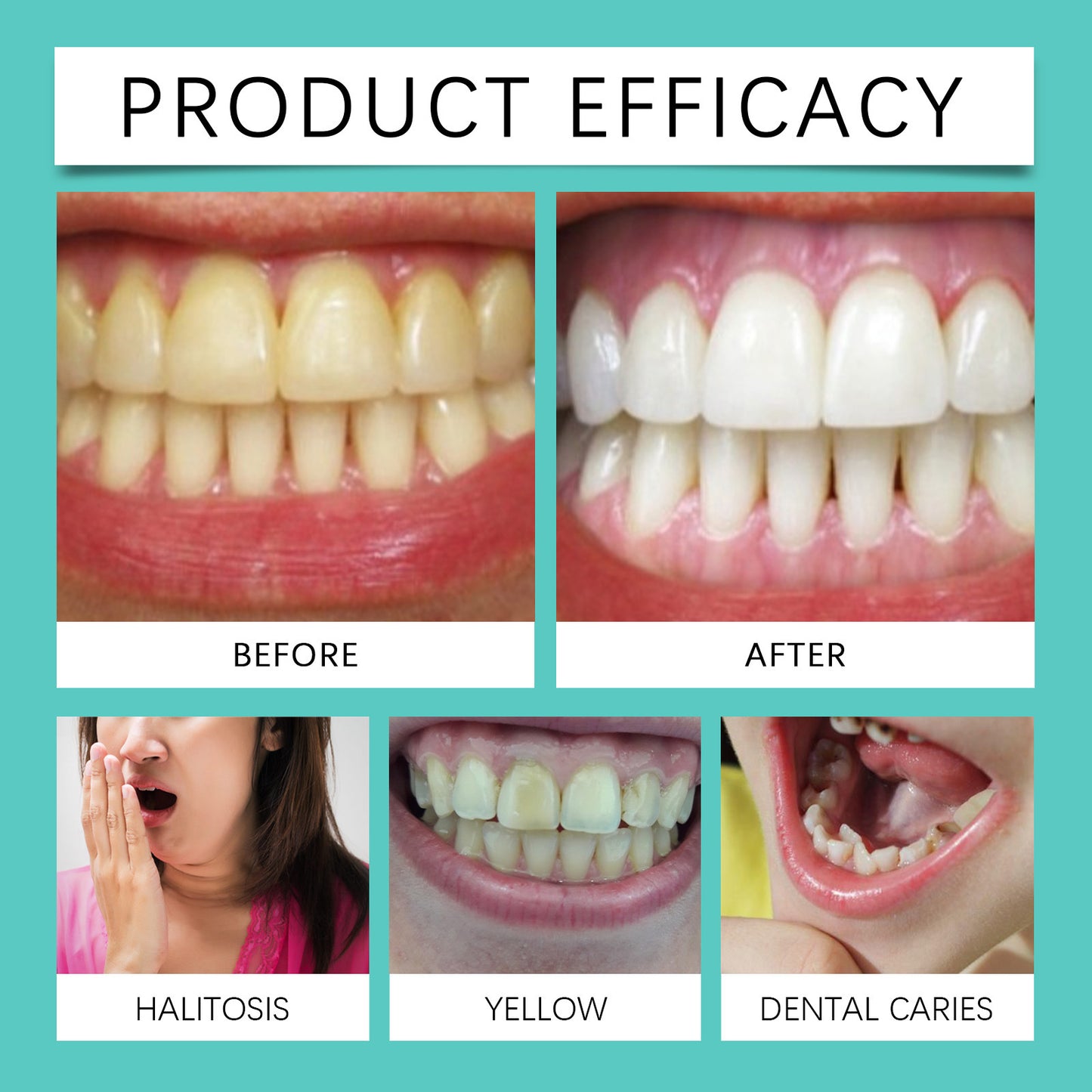 π Anniversary Big Sale Up To 50% 0FF π€ Whitening Strips - JSS6