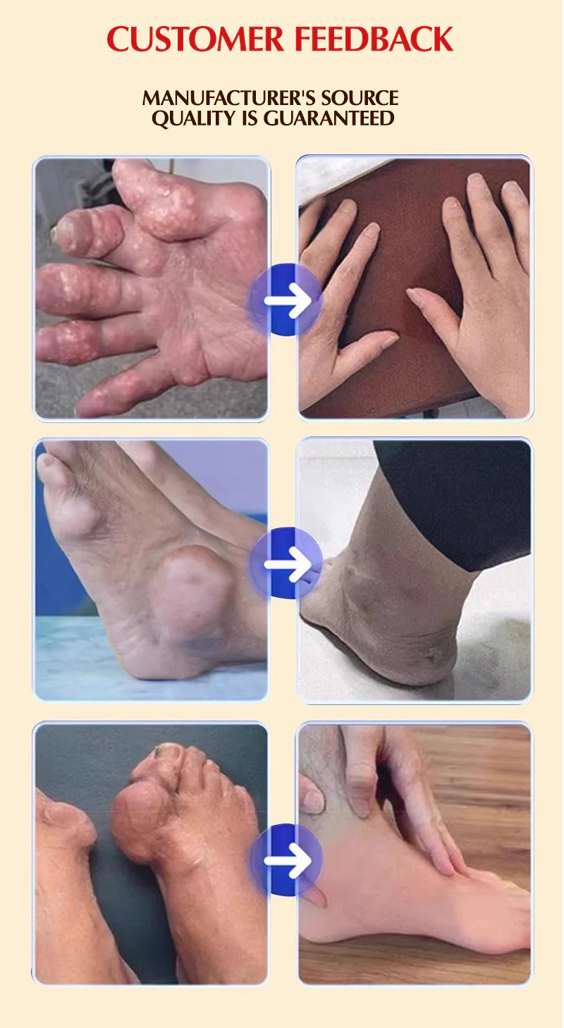 BoneRelief Advanced Pain Relief Patch - JSS6