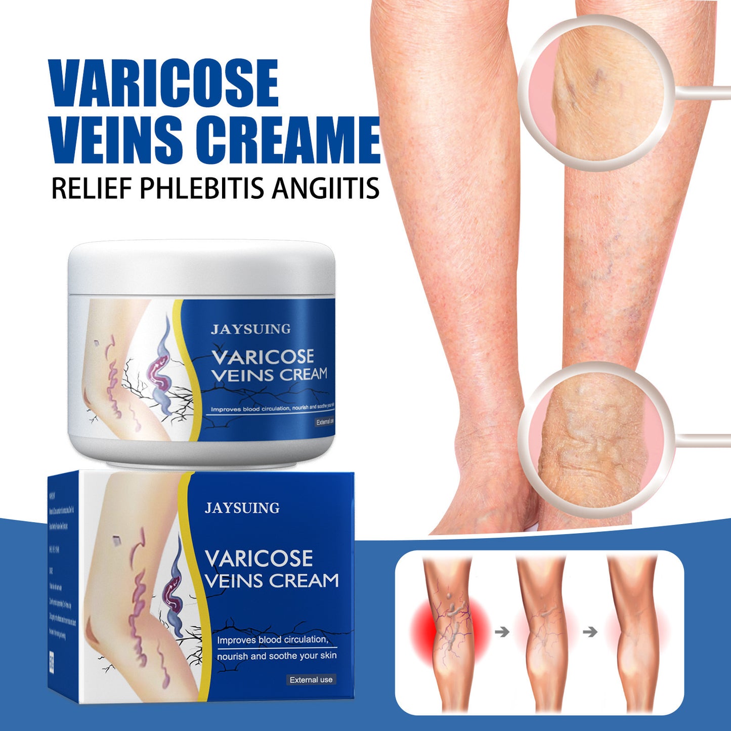 π LAST DAY PROMOTION - 50%OFF π Leg Relief Varicose Veins Cream - JSS6
