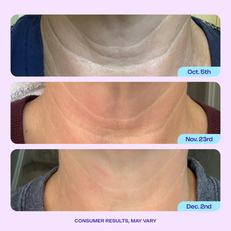🔥First 100:2nd Item 60%Off🔥Advanced Firming Neck Cream-w18