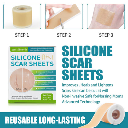✨ LAST DAY PROMOTION - 50%OFF✨-Professional Silicone Scar Sheets-ABB8