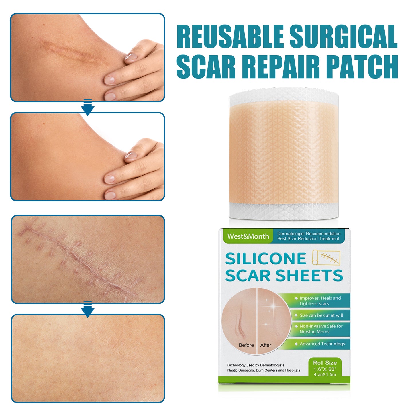 ✨ LAST DAY PROMOTION - 50%OFF✨-Professional Silicone Scar Sheets-ABB8