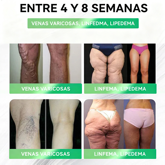 𝑳𝒖𝒎𝒆𝒃𝒍𝒐𝒐𝒎® 𝑮𝑳𝑷-𝟏 𝟖 𝒆𝒏 𝟏 𝑭𝒊𝒕 & 𝑽𝒊𝒕𝒂𝒍 (𝒔𝒐𝒍𝒐 𝒖𝒏𝒂 𝒗𝒆𝒛 𝒂𝒍 𝒅𝒊́𝒂, 𝒄𝒂𝒎𝒃𝒊𝒐𝒔 𝒗𝒊𝒔𝒊𝒃𝒍𝒆𝒔 𝒆𝒏 𝟕 𝒅𝒊́𝒂𝒔) √ 𝑷𝒂𝒓𝒂 𝒐𝒃𝒆𝒔𝒊𝒅𝒂𝒅, 𝒔𝒂𝒍𝒖𝒅 𝒄𝒂𝒓𝒅𝒊𝒐𝒗𝒂𝒔𝒄𝒖𝒍𝒂𝒓, 𝒅𝒊𝒂𝒃𝒆𝒕𝒆𝒔, 𝒂𝒑𝒏𝒆𝒂 𝒅𝒆𝒍 𝒔𝒖𝒆𝒏̃𝒐, 𝒔𝒂𝒍𝒖𝒅 𝒊𝒏𝒕𝒆𝒔𝒕𝒊𝒏𝒂𝒍, 𝒑𝒓𝒐𝒃𝒍𝒆𝒎𝒂𝒔 𝒂𝒓𝒕𝒊𝒄𝒖𝒍𝒂𝒓𝒆𝒔 𝒚 𝒎𝒂́𝒔-H1 xy