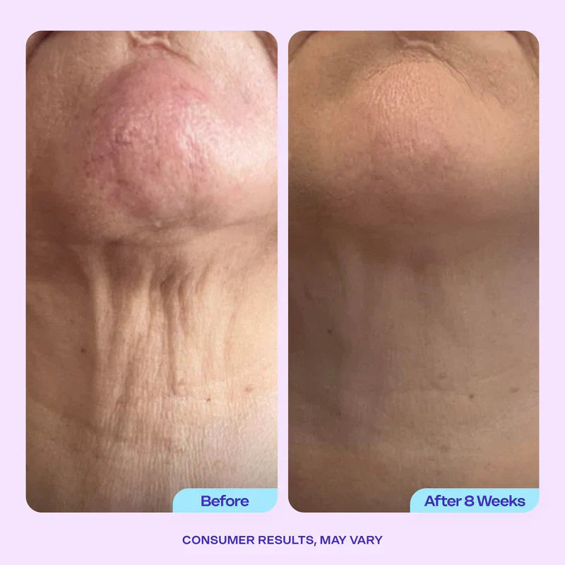 🔥First 100:2nd Item 60%Off🔥Advanced Firming Neck Cream-w18