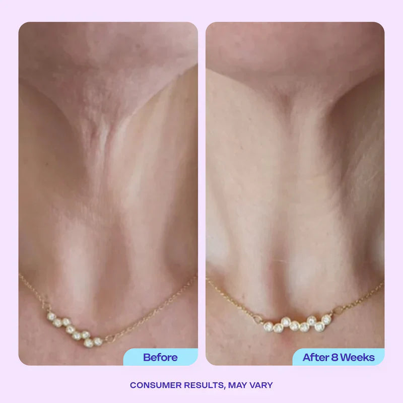 🔥First 100:2nd Item 60%Off🔥Advanced Firming Neck Cream-w18