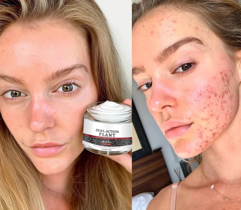 🔥First 100:2nd Item 60%Off🔥Black Rice Soothing Repair Cream-W18