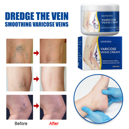 💙 LAST DAY PROMOTION - 50%OFF 💙 Leg Relief Varicose Veins Cream - JSS6