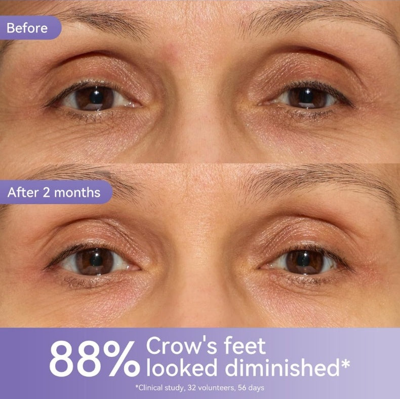 🎁Buy 1 get 1 free💜Retinol Soothing Eye Cream Hydrating, Moisturizing and Fading Fine Lines Essence Cream-w24