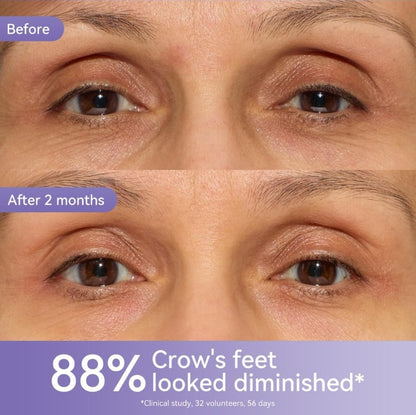 🎁Buy 1 get 1 free💜Retinol Soothing Eye Cream Hydrating, Moisturizing and Fading Fine Lines Essence Cream-w24