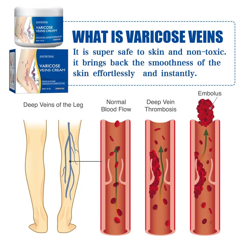 🏆Flash Sale⚡ 50K+ SOLD! Almost Gone💥-JAYSUING Varicose Veins Cream, Leg Massage Cream, Skin Firming Cream Leg Care Cream-H1
