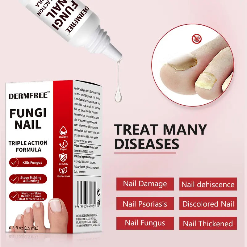 💜 LAST DAY PROMOTION -50% OFF👇Toenail Fungus Treatment Extra Strength-ABB8