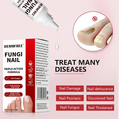 💜 LAST DAY PROMOTION -50% OFF👇Toenail Fungus Treatment Extra Strength-ABB8