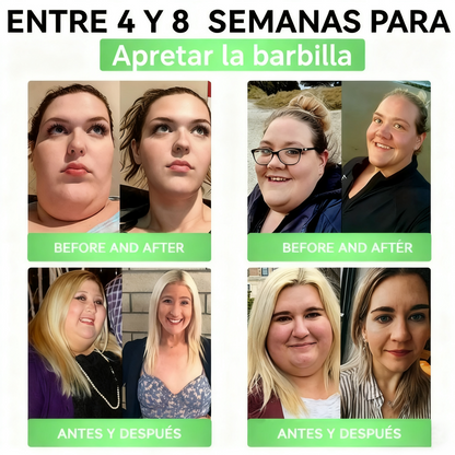 Lumebloom® GLP-1 20 en 1 Suplemento Adelgazante (Resultados Visibles en 7 Días) ayuda a mejorar la obesidad, la salud cardiovascular, la diabetes, la salud intestinal, los problemas articulares, una piel más firme y un aumento de energía.-XA