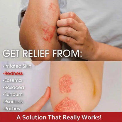 🏆Flash Sale⚡ 50K+ SOLD! Almost Gone💥-Plant-Based Herbal Relief Cream-H1