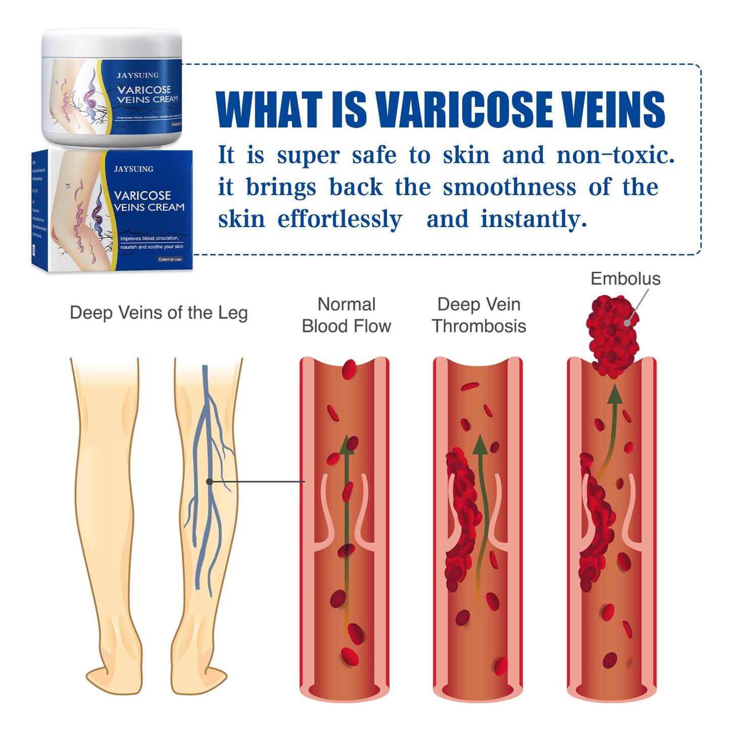 💙 LAST DAY PROMOTION - 50%OFF 💙 Leg Relief Varicose Veins Cream - JSS6
