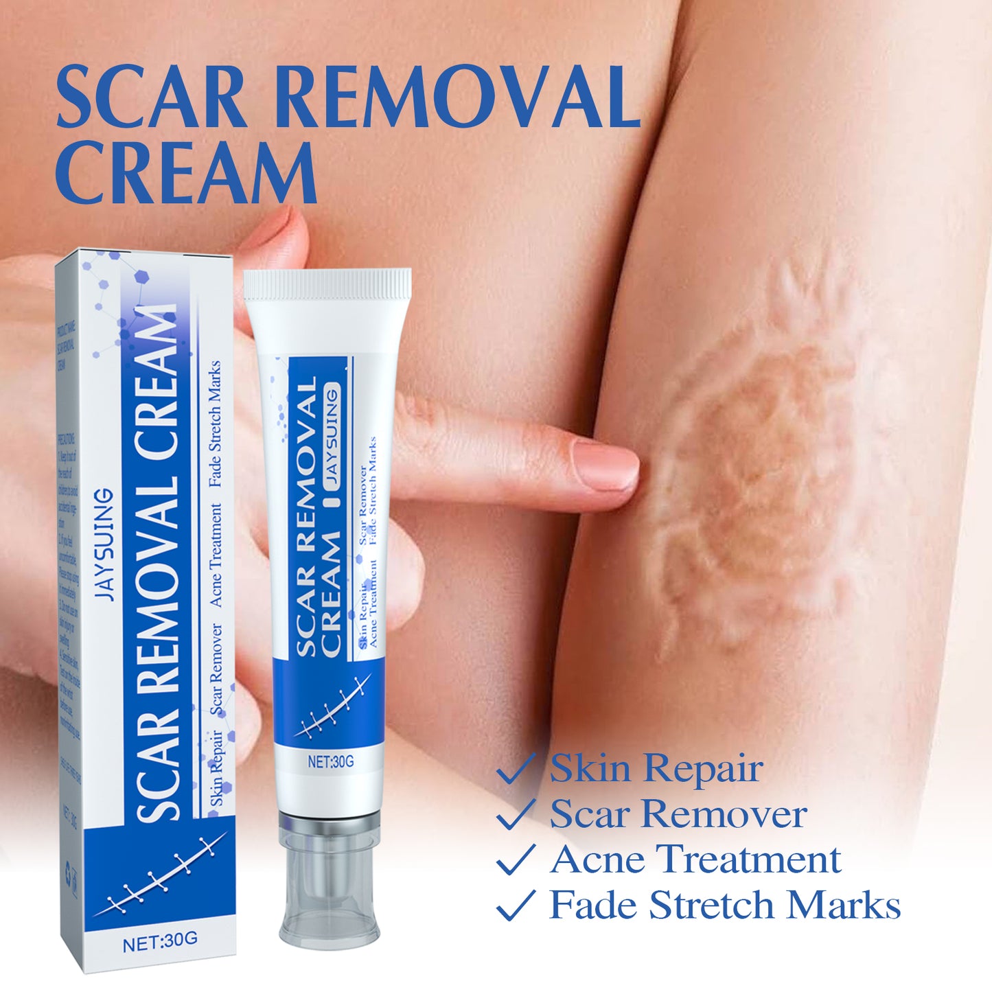 ✨ LAST DAY PROMOTION - 50%OFF✨-Softens and smoothens scars Scar Cream-ABB8