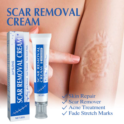 ✨ LAST DAY PROMOTION - 50%OFF✨-Softens and smoothens scars Scar Cream-ABB8