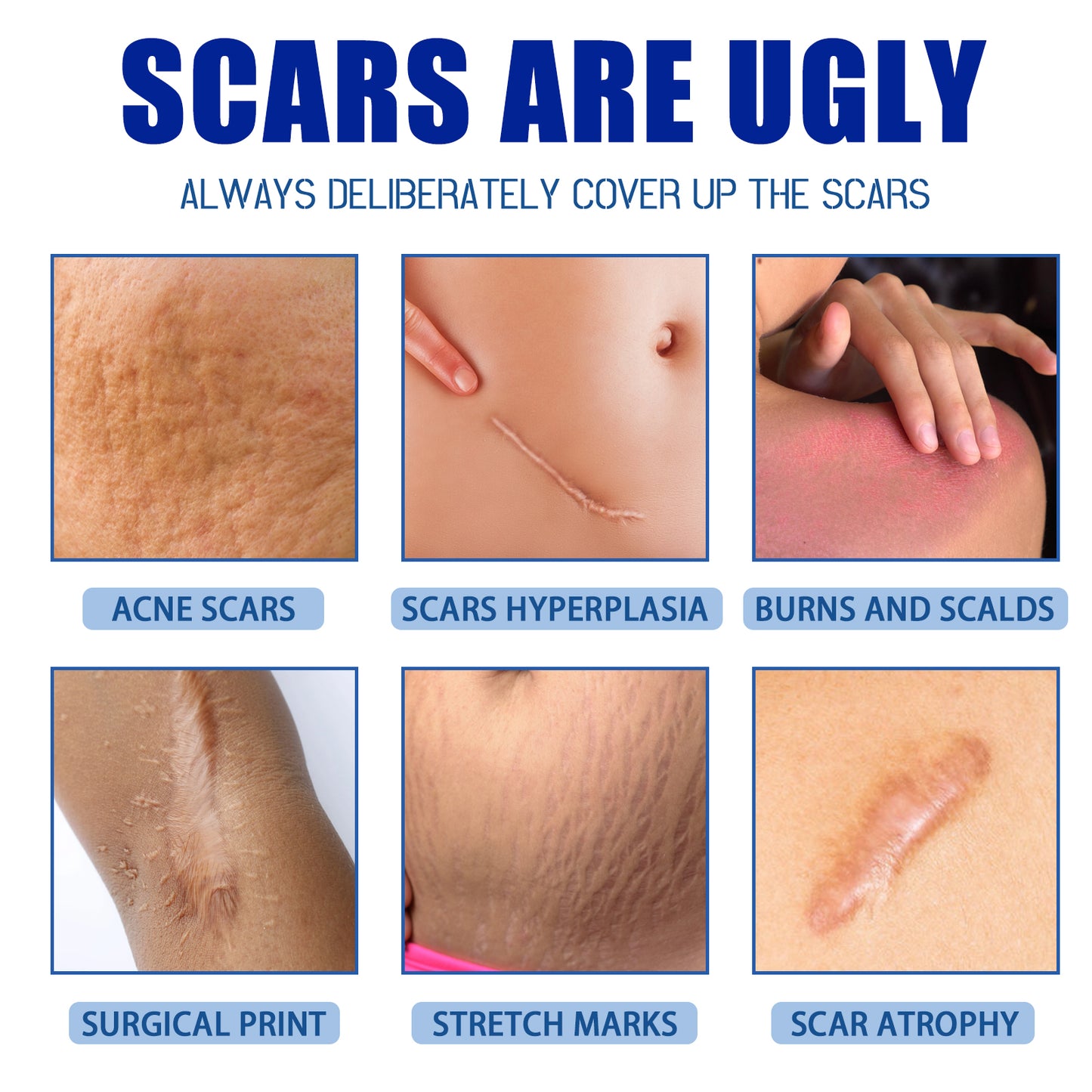 ✨ LAST DAY PROMOTION - 50%OFF✨-Softens and smoothens scars Scar Cream-ABB8