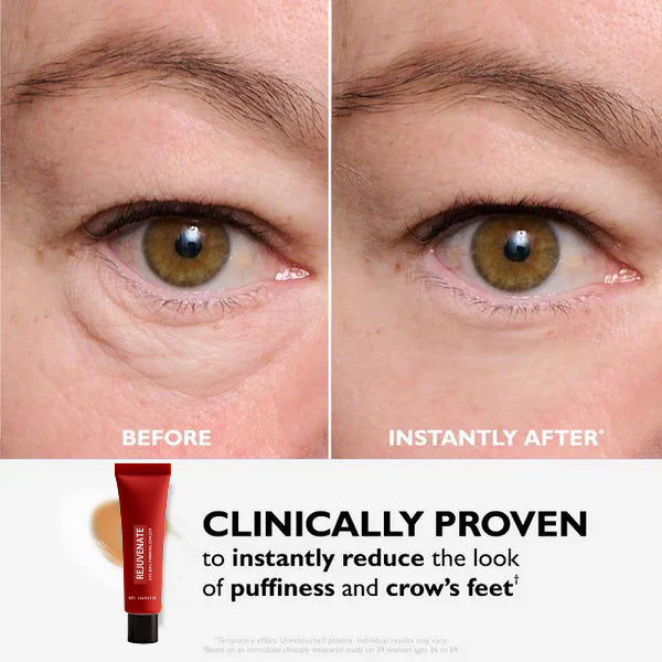 🔥Last 3 Hours 50% OFF✨️EyeBag Eraser -W18