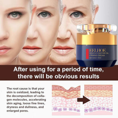 ✨ LAST DAY PROMOTION - 50%OFF✨-Tightening and Anti-Wrinkle Cream-ABB8